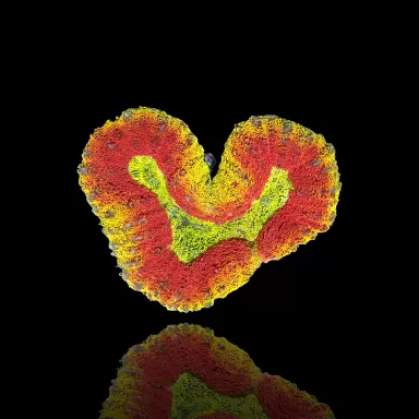 Lobophyllia sp.Multi Coloured (rare) - Australie S-Size